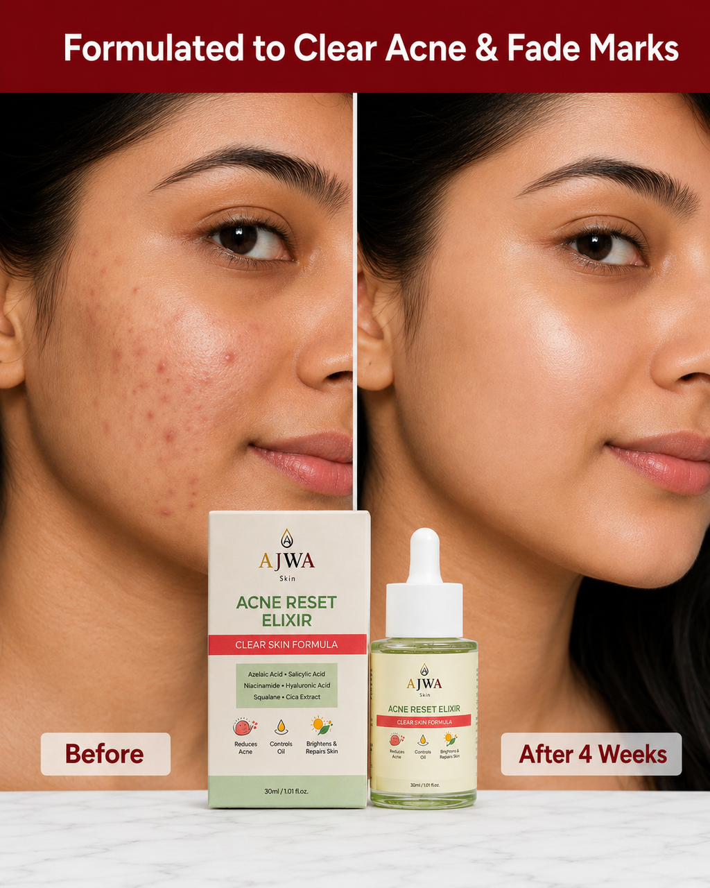 AJWA Skin Acne Reset Elixir
