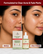 AJWA Skin Acne Reset Elixir